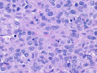 James' 100 Miles in May; 2.6