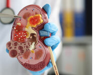 Cromer Renal Refresh