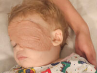 Supporting Childhood Eye Cancer Trust