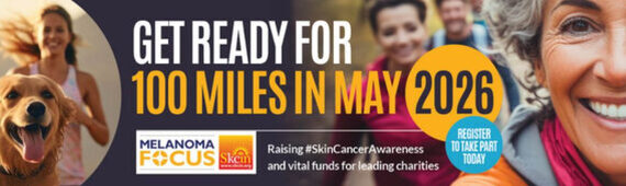 Alan's May Challenge for Melananoma