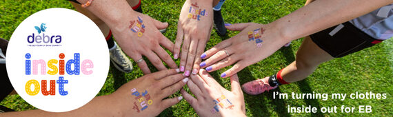 DEBRA UK colleagues 'Inside Out' Day!