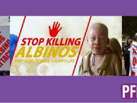 'I'm Nobody's Magic' - Feature film on Albinism